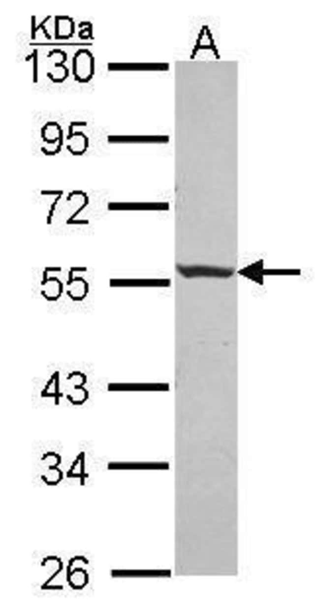 ANTI-ICA1