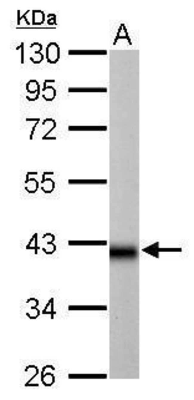 ANTI-IDH3A