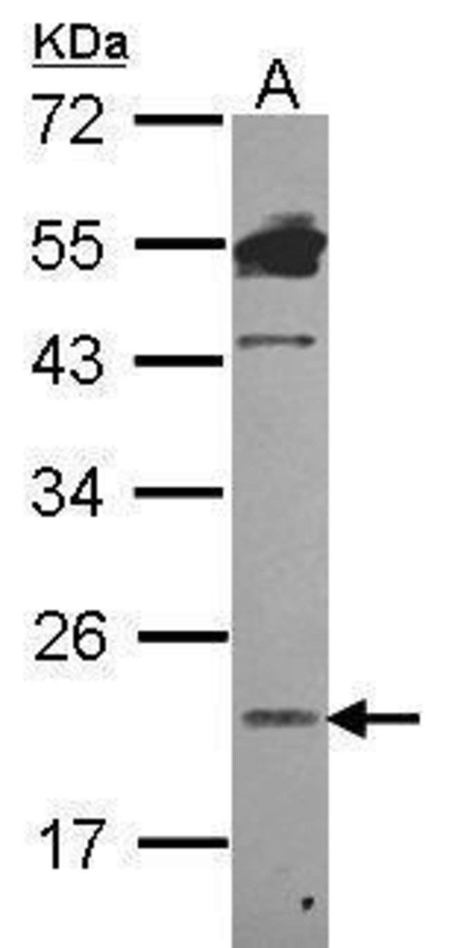 ANTI-LIPOCALIN 1