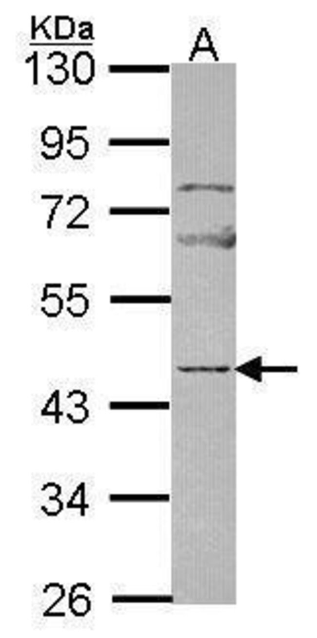 ANTI-NP2