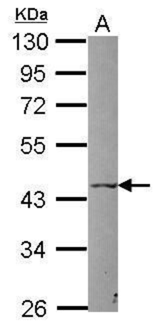 ANTI-P2X5