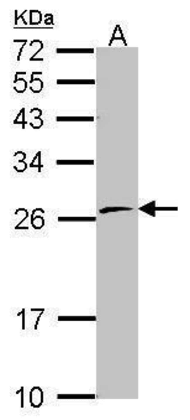 ANTI-RNA POLYMERASE IIE