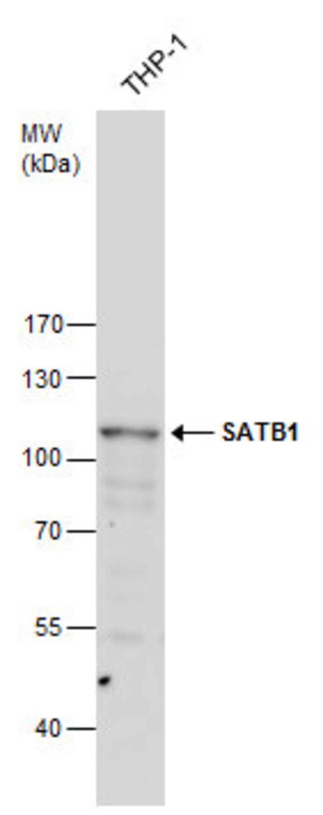 ANTI-SATB1