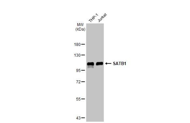 ANTI-SATB1