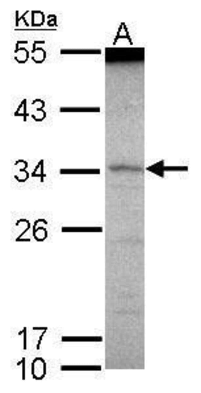 ANTI-SCML1