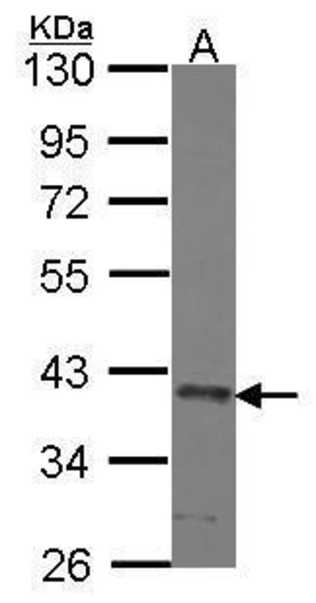 ANTI-SEC13L1