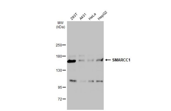 ANTI-SMARCC1