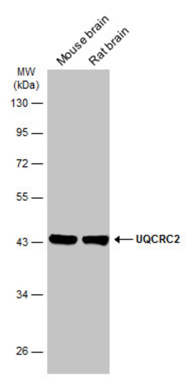 ANTI-UQCRC2