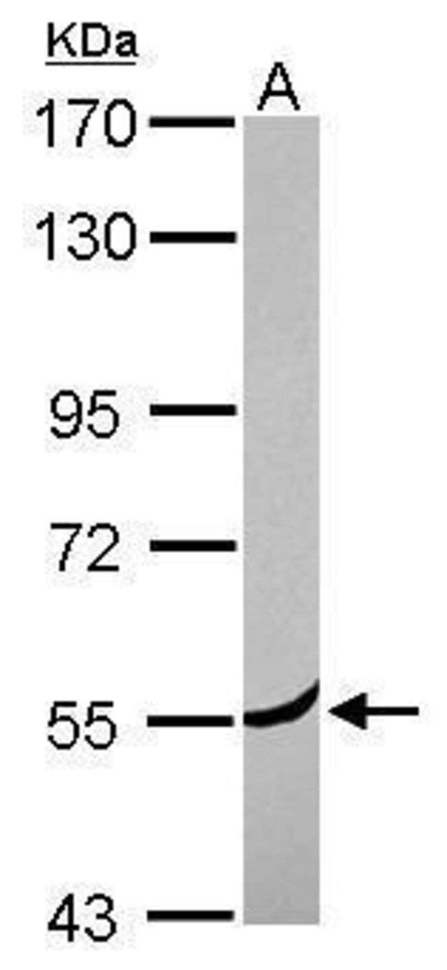 ANTI-CORONIN 2A