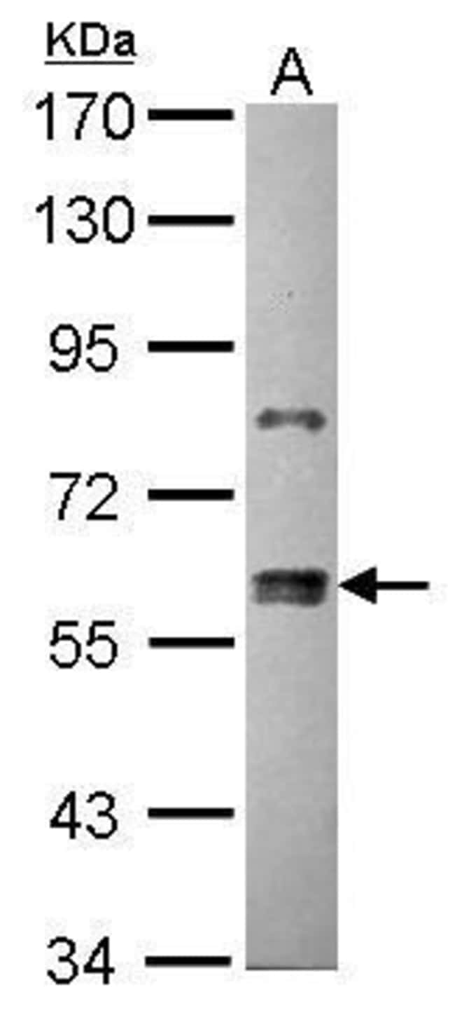 ANTI-ZNF133