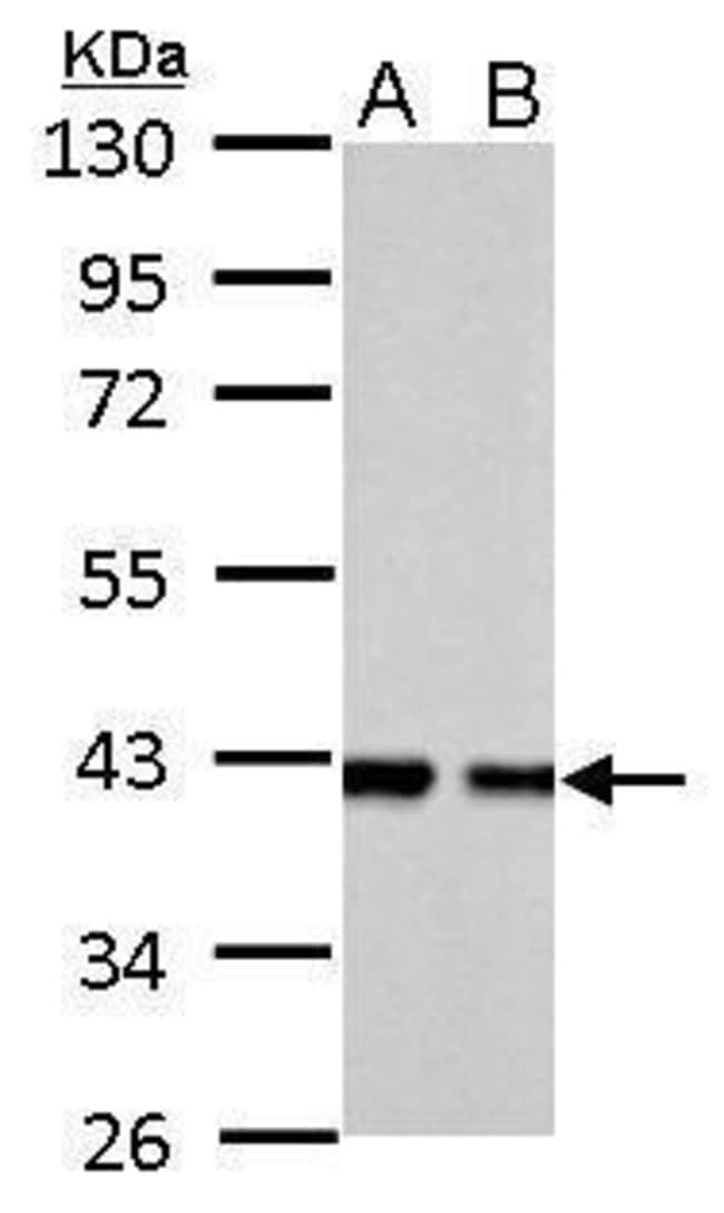 ANTI-ALDOLASE B