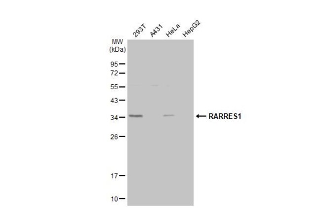 ANTI-TIG1