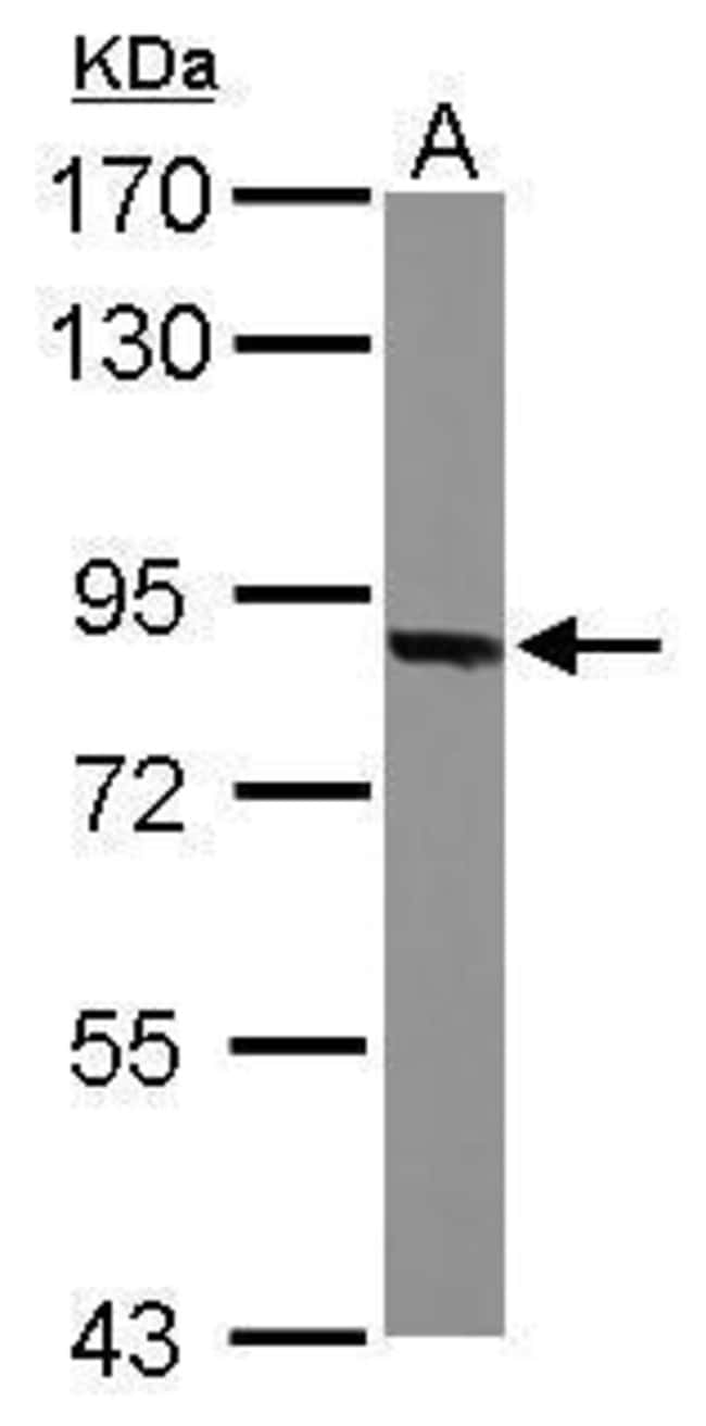 ANTI-THIMET OLIGOPEPTIDASE