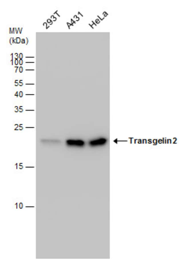 ANTI-TRANSGELIN 2