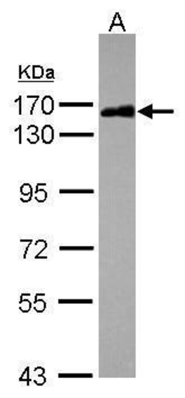 ANTI-SCAFFOLD ATTACHMENT FACTOR B2