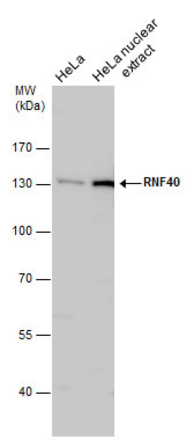 ANTI-RNF40