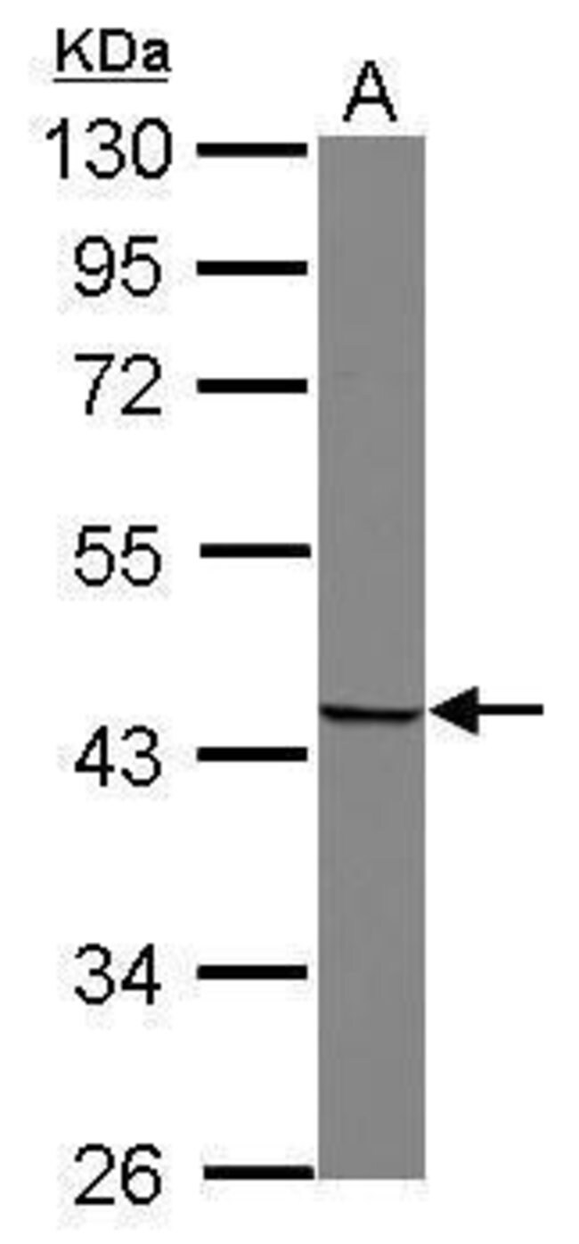 ANTI-SNURPORTIN 1