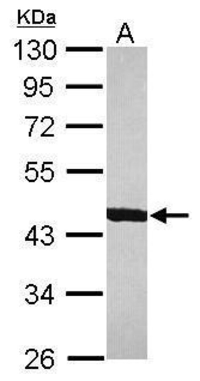 ANTI-BETA CENTRACTIN