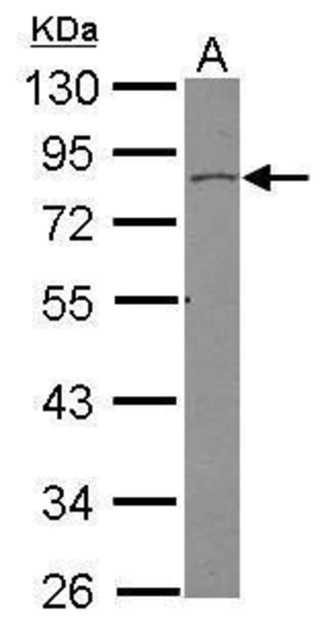 ANTI-VINEXIN