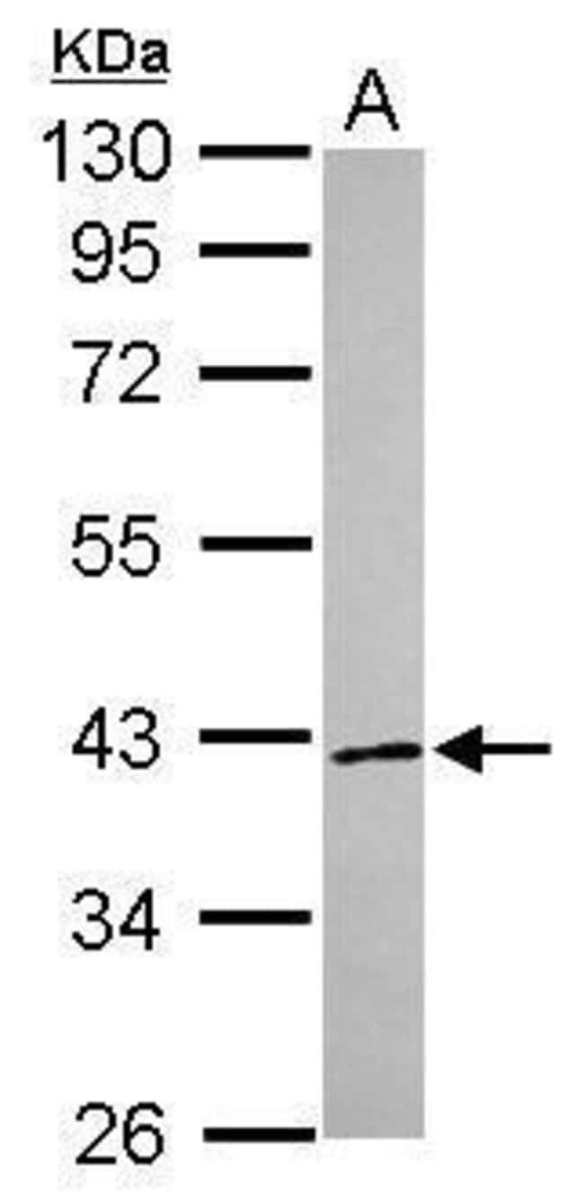 ANTI-RNF41