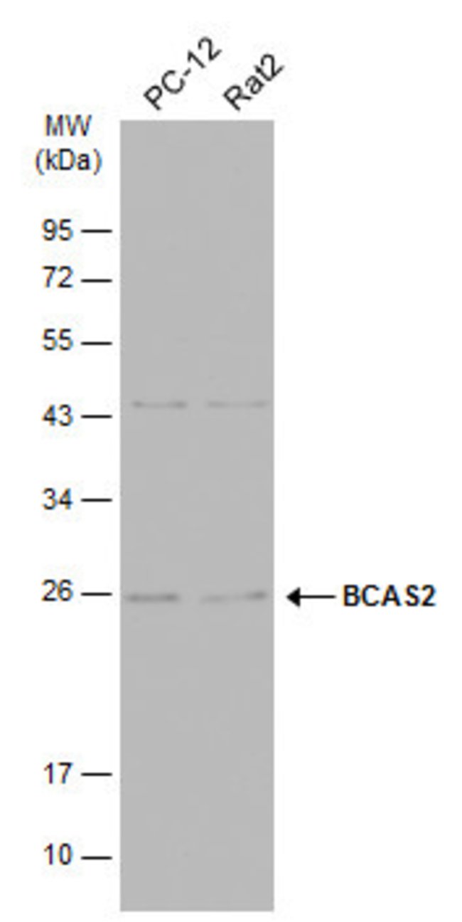 ANTI-BCAS2