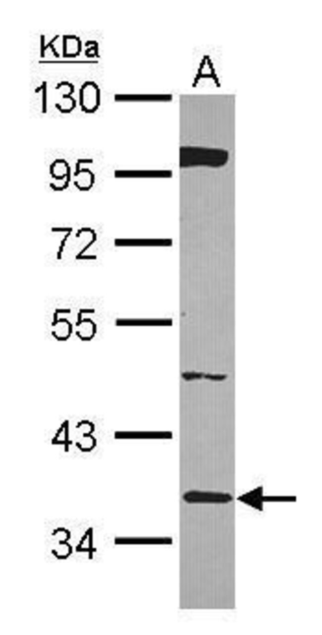 ANTI-HMG20B