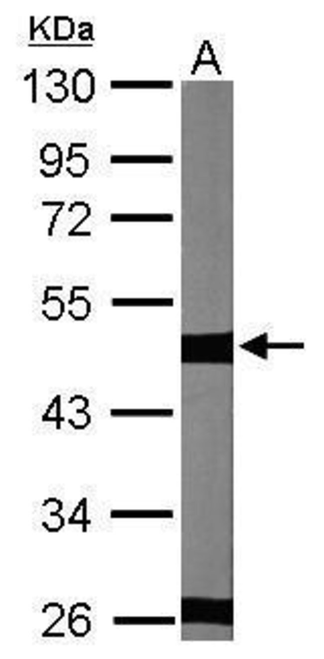 ANTI-BETA TULULIN 2C