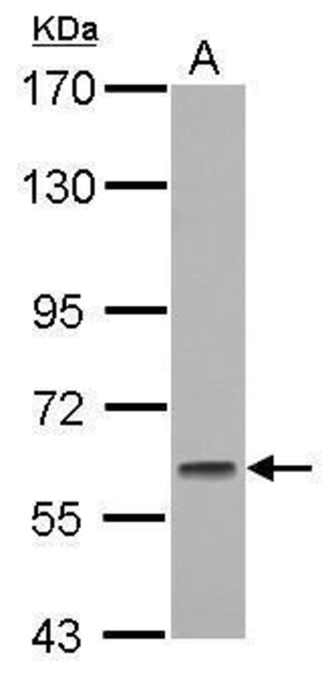 ANTI-GMEB1