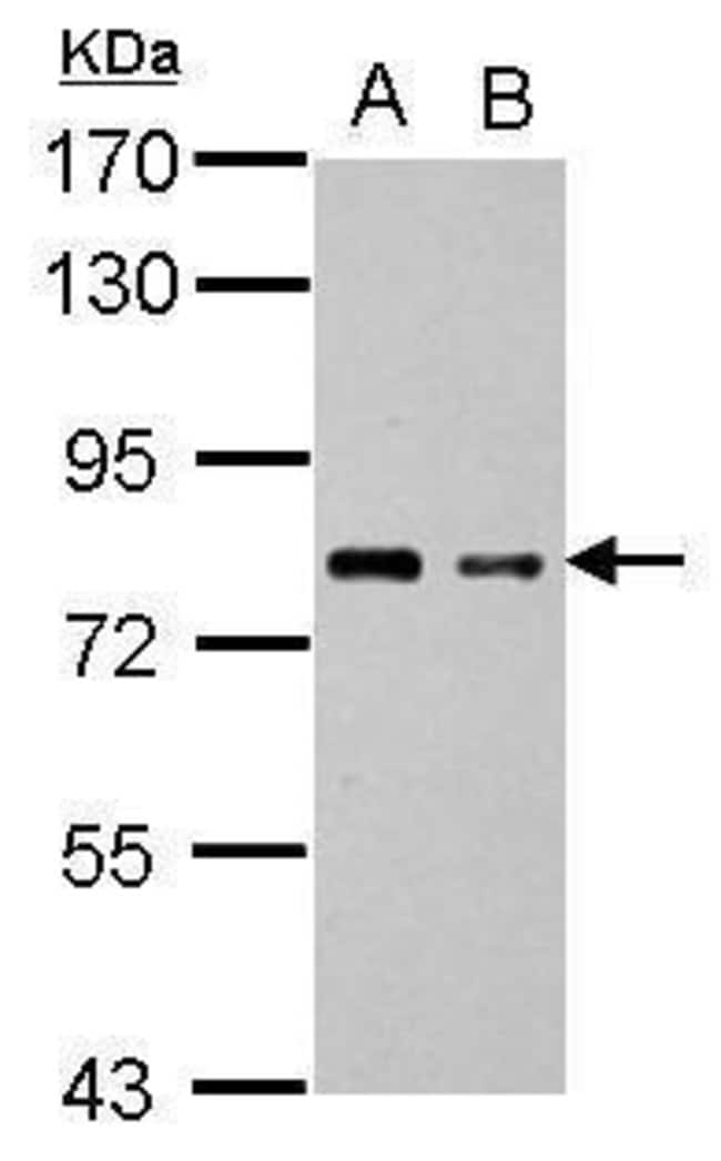 ANTI-PRDM4