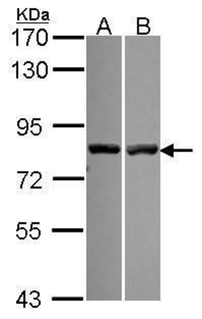 ANTI-CALPAIN 11