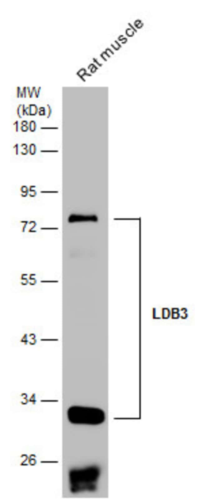 ANTI-LDB3