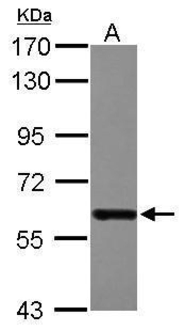 ANTI-DDX19B