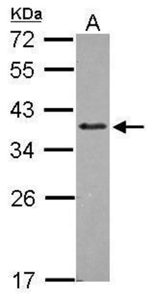 ANTI-ZNF346