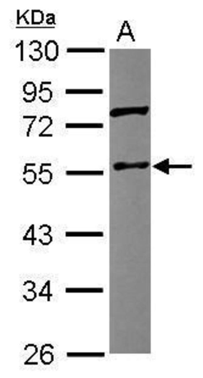 ANTI-CORONIN 1C