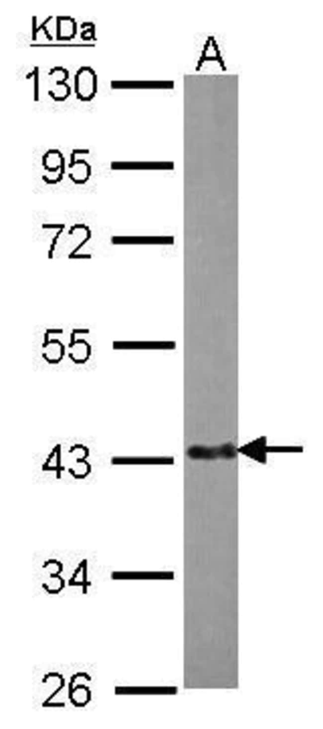 ANTI-EML2