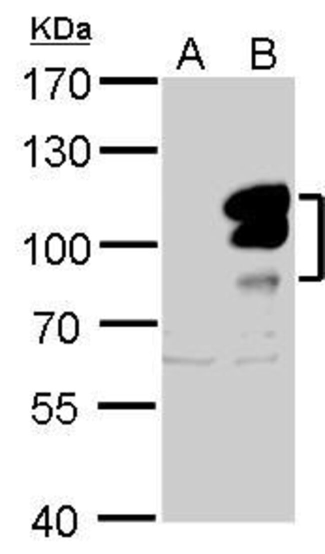 ANTI-L3MBTL