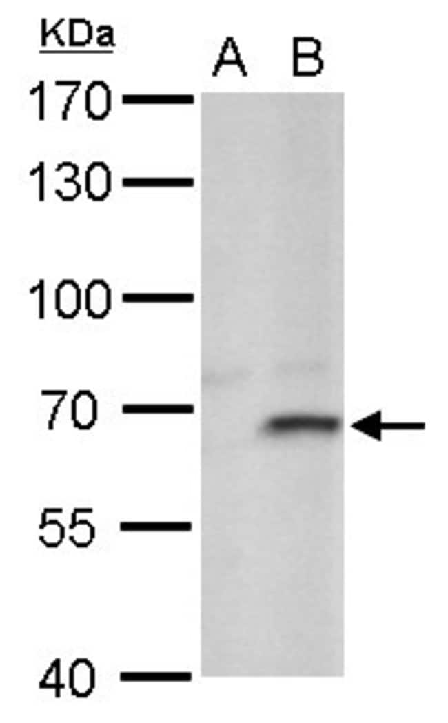 ANTI-FBL4