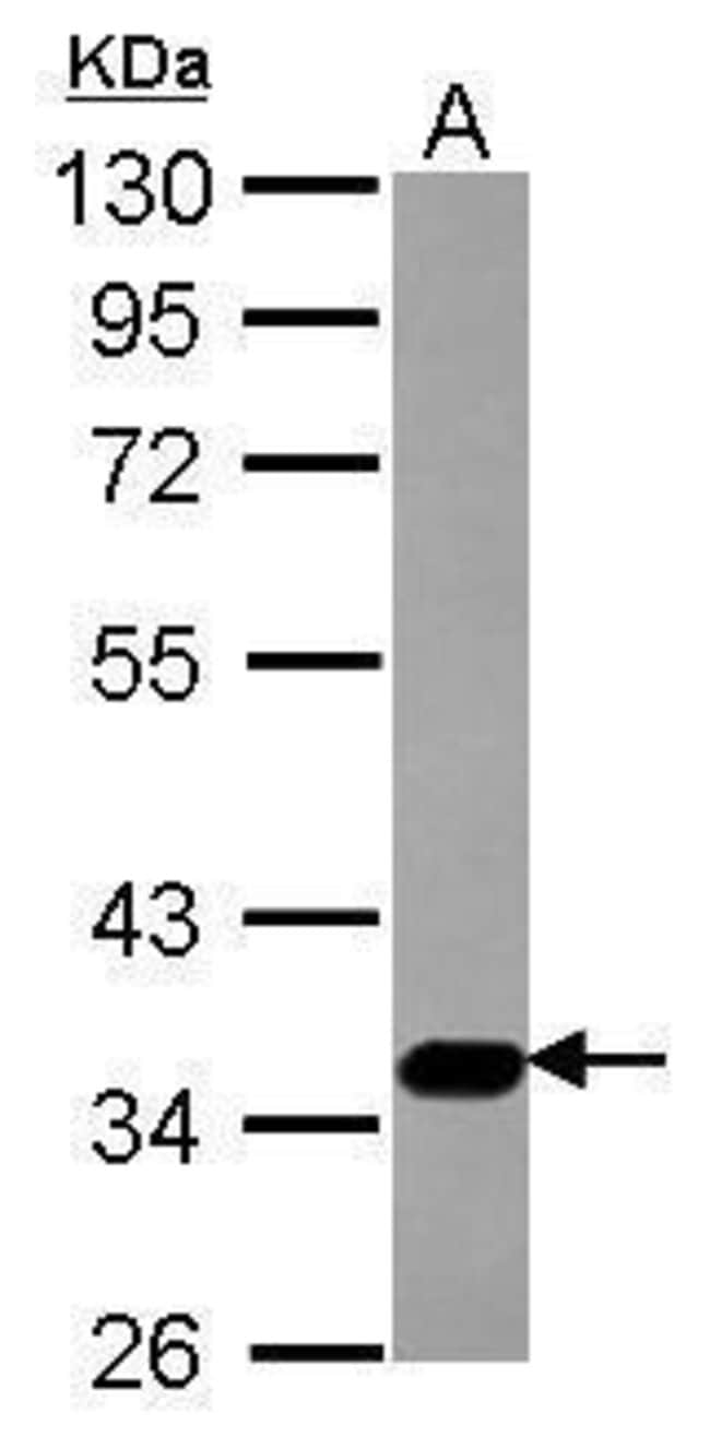 ANTI-SLC17A5