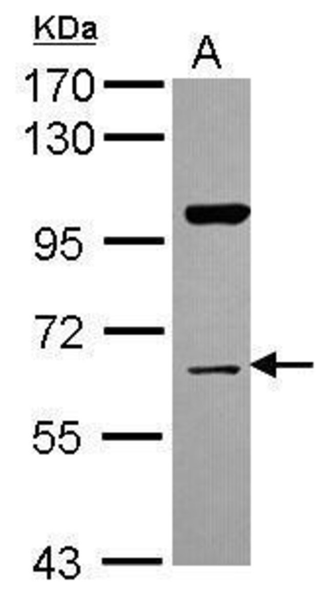 ANTI-NRBP