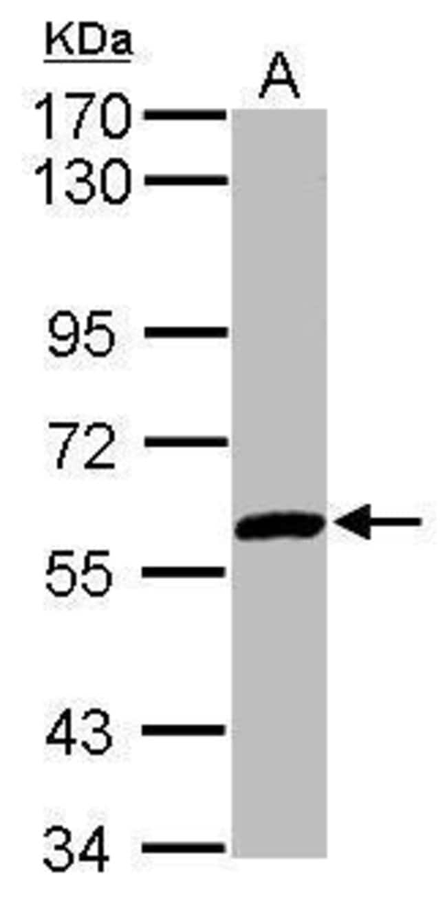 ANTI-ZNF345