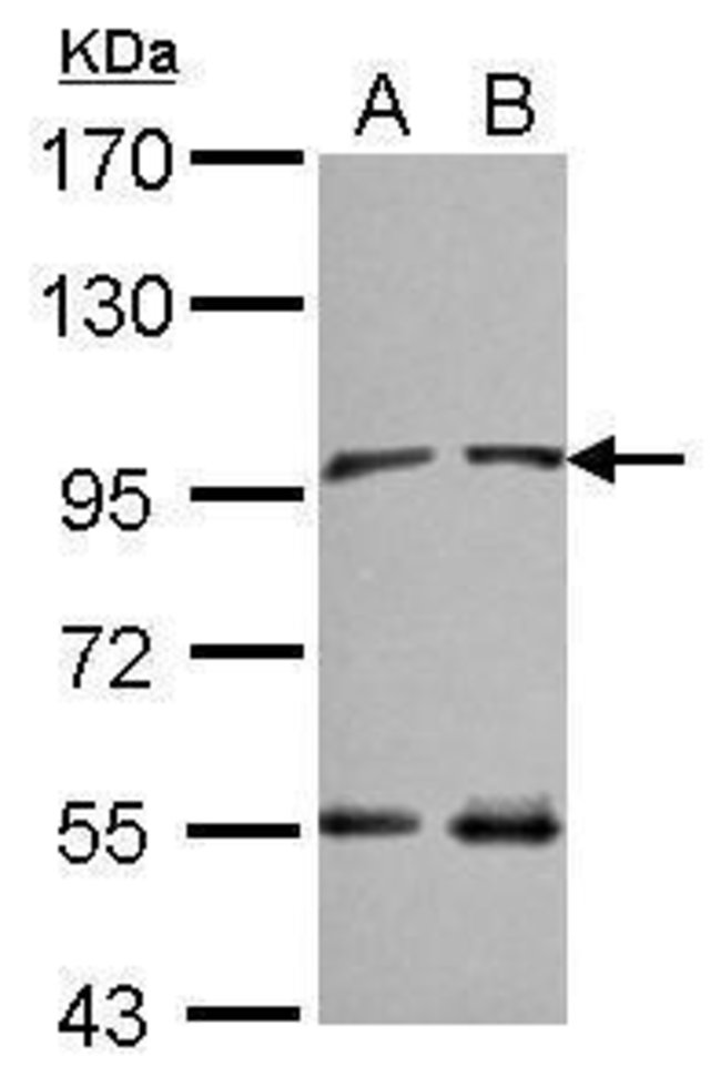 ANTI-NARG1