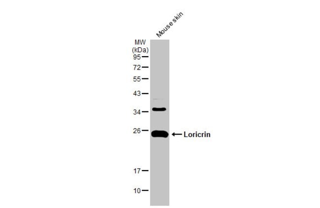 ANTI-LORICRIN