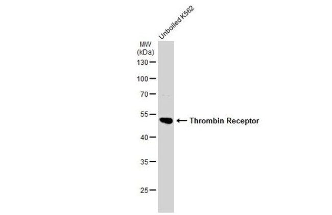 ANTI-THROMBIN RECEPTOR