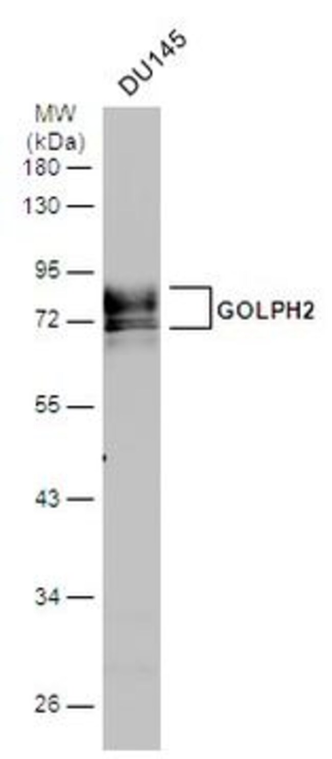 ANTI-GOLPH2