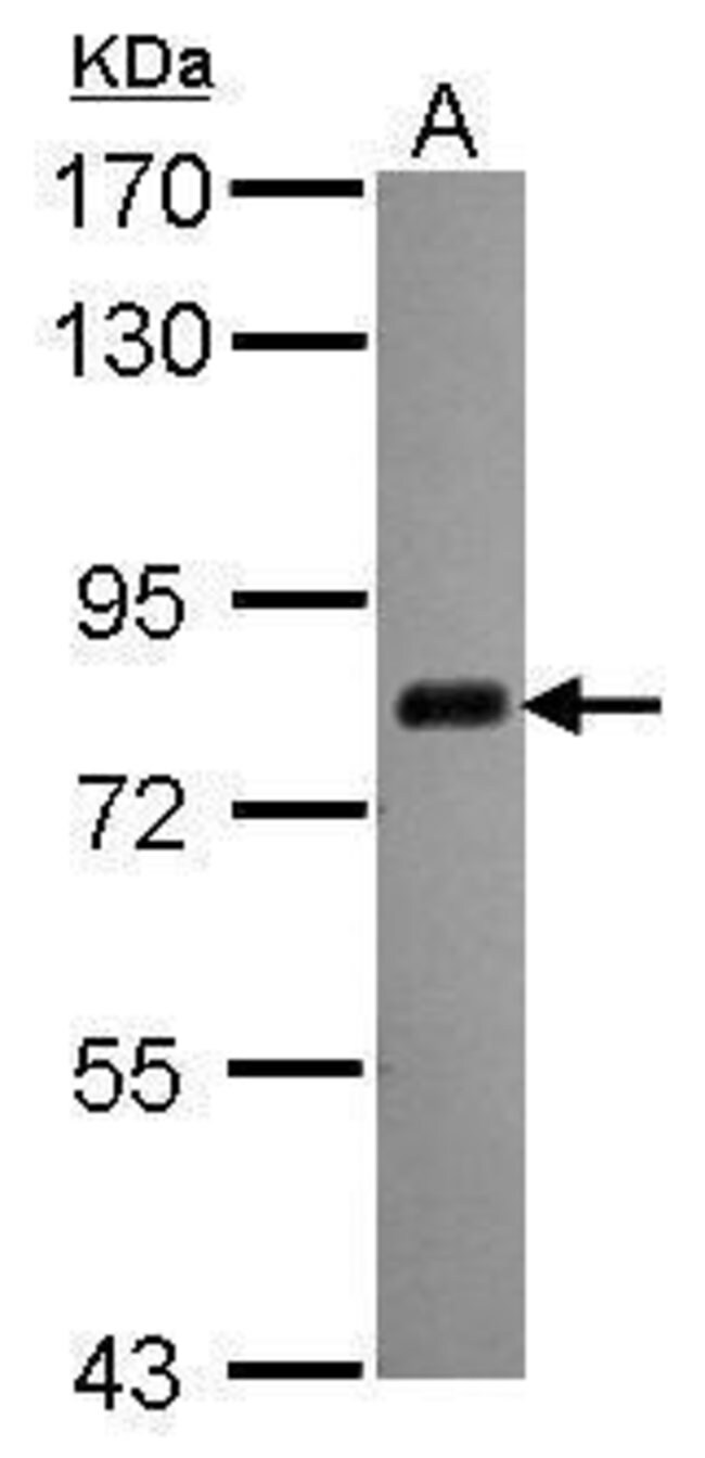 ANTI-CPSF73