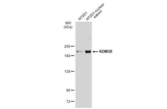 ANTI-KDM3B