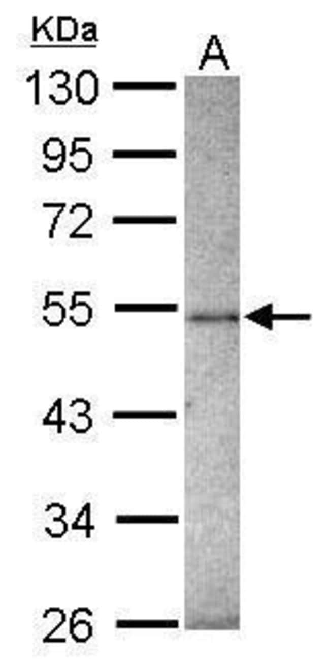 ANTI-ZNF213