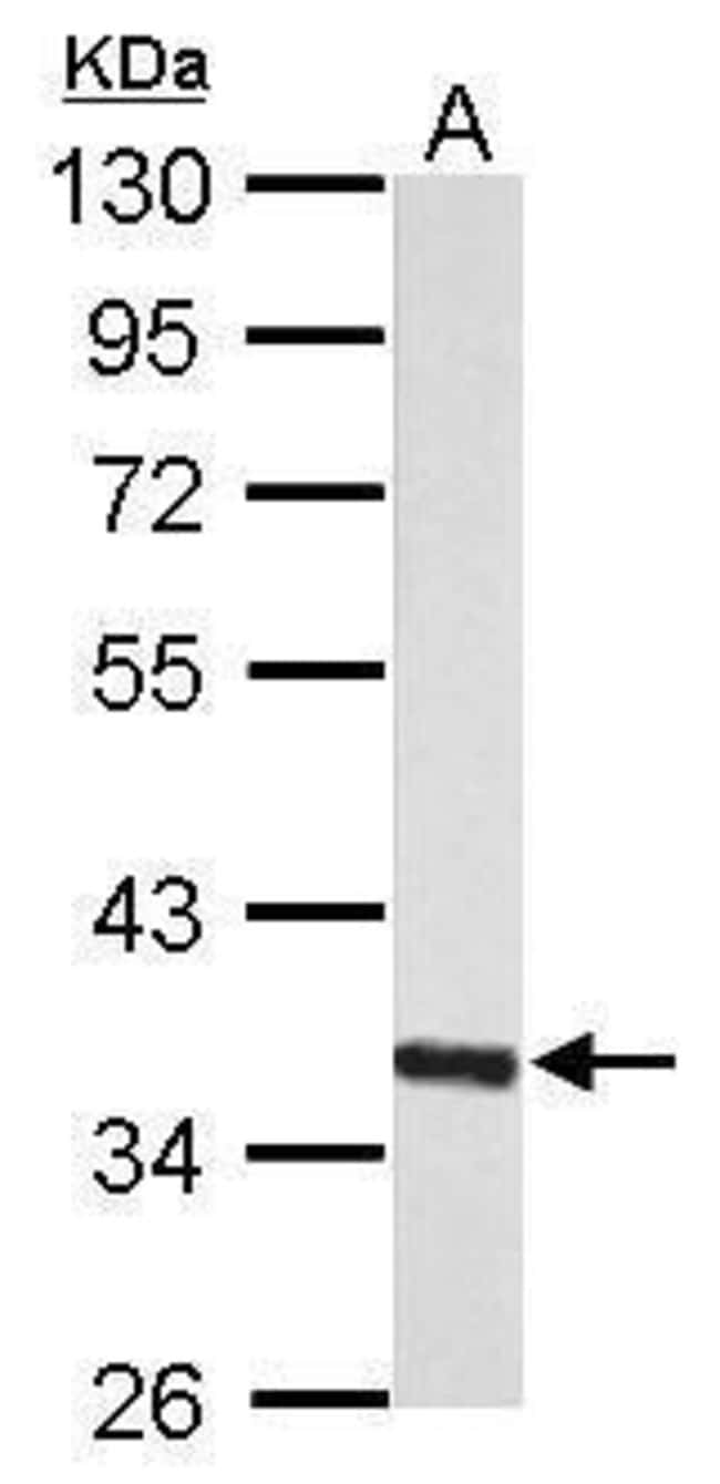 ANTI-MYO-INOSITOL OXYGENASE