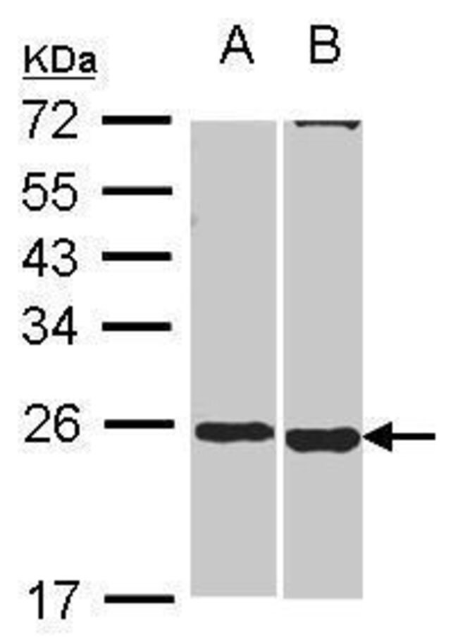 ANTI-SOHLH2