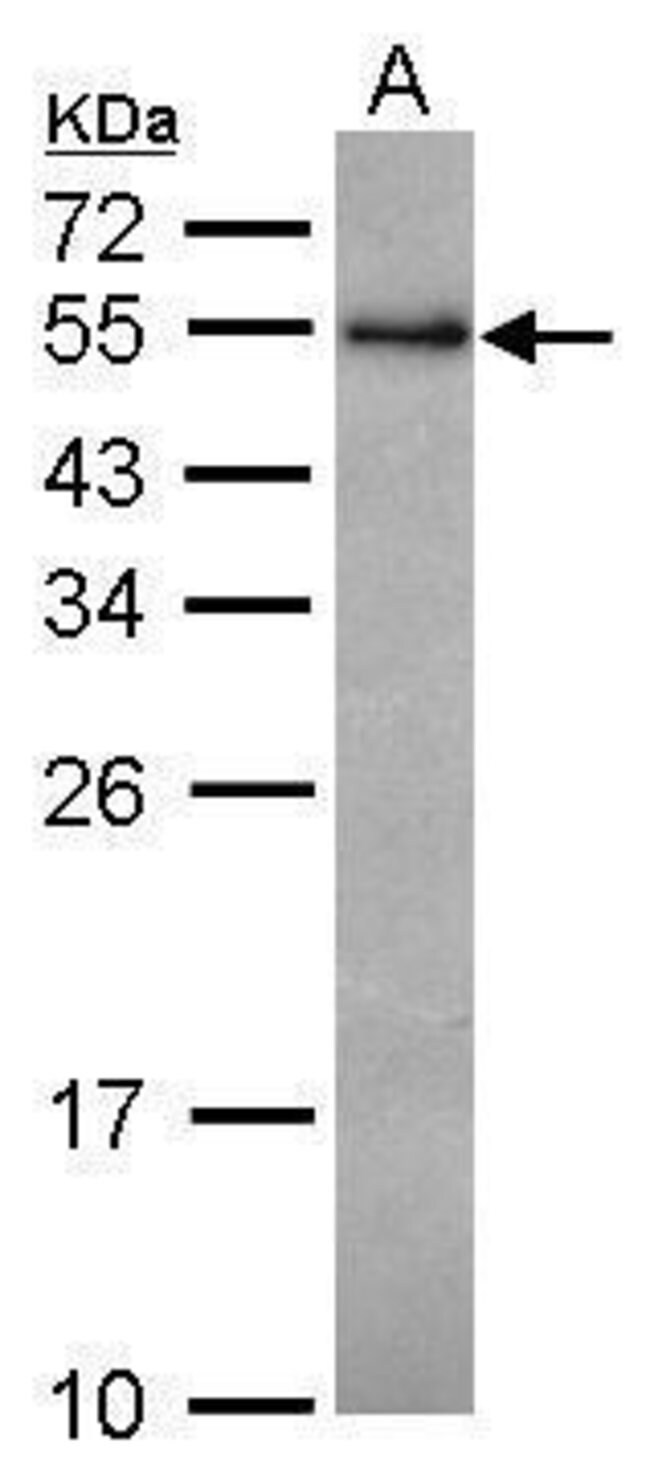 ANTI-RCBTB1